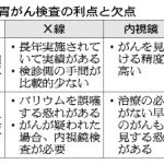 厚労省 胃がん検診、内視鏡推奨せず、バリウムを飲むX線検査を推奨