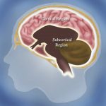 脳の後部皮質領域(”posterior hot zone”)に「夢の中枢」がある