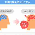 大人の耳鳴りは老化現象、薬は効かず